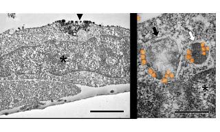  Internalizzazione delle nanoplastiche di polistirene nella linea cellulare di trota. Immagine al microscopio elettronico a trasmissione (TEM)
